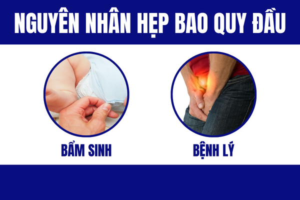 Hep-bao-quy-dau-hoi-chung-nguy-hiem-pho-bien-o-nam-gioi-2