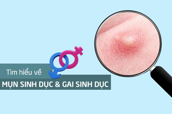 Phân biệt mụn sinh dục và gai sinh dục ở nam, nữ giới 