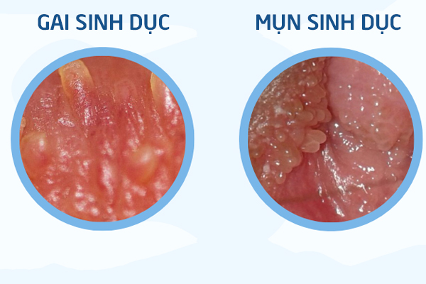 Phan-biet-mun-sinh-duc-va-gai-sinh-duc-4