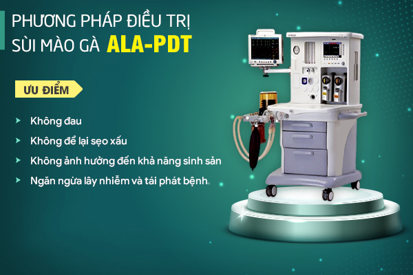 Phương pháp ALA-PDT hỗ trợ điều trị sùi mào gà