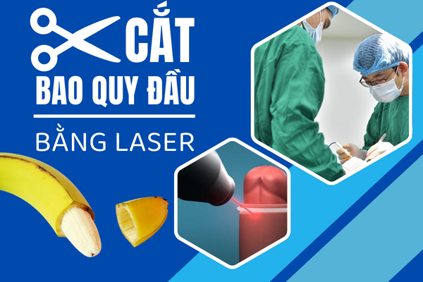 Phuong-phap-cat-bao-quy-dau-bang-laser-0