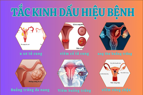 Tắc kinh nguyệt – Cảnh báo điều gì ở sức khỏe nữ giới