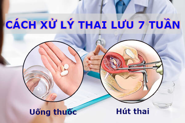 Thai lưu 7 tuần nên hút hay uống thuốc? Cách xử lý hiệu quả