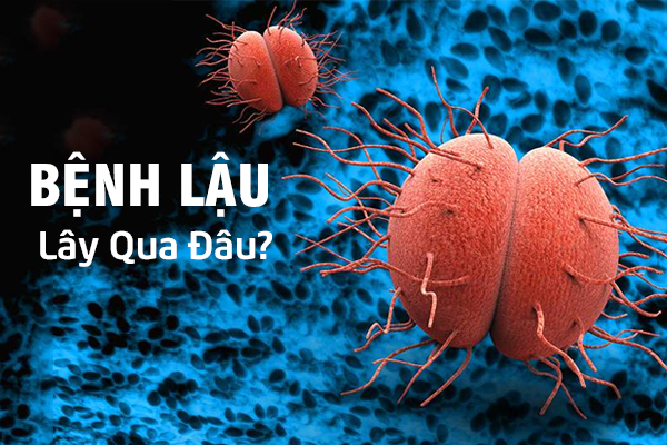 Bệnh lậu lây qua đâu? Triệu chứng nhận biết bệnh