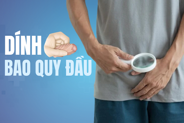 Hiểu đúng về dính bao quy đầu để trị đúng cách.