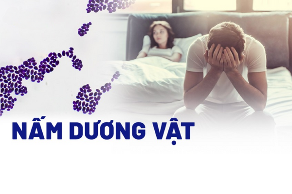 Nấm dương vật là gì và làm sao điều trị?