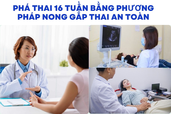 Phương pháp phá thai 16 tuần