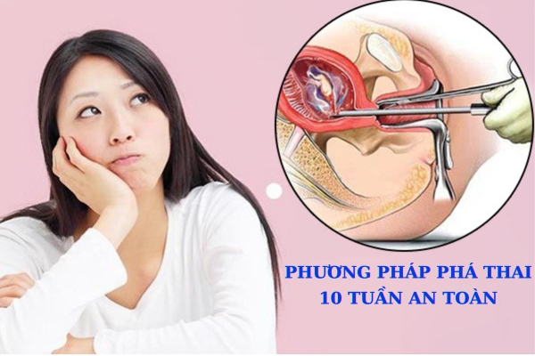 Phương pháp phá thai 10 tuần tuổi an toàn