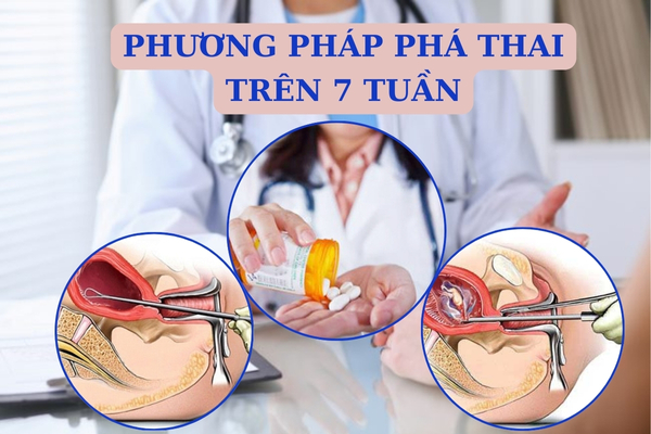 Phương pháp phá thai trên 7 tuần