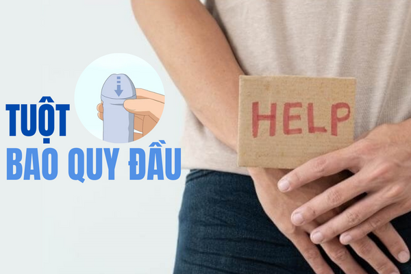 Tuột bao quy đầu khó khăn do đâu và giải quyết ra sao?