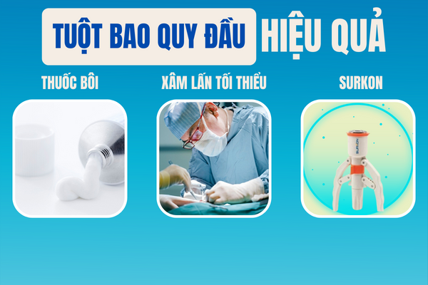 Tuot-bao-quy-dau-kho-khan-do-dau-va-giai-quyet-ra-sao-2