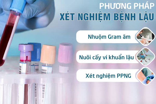 Xet-nghiem-benh-lau-3