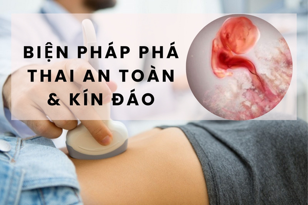 Biện pháp phá thai an toàn – kín đáo – ít đau