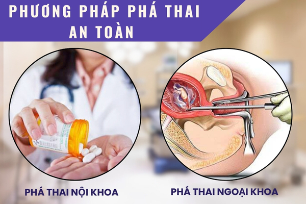 Các phương pháp bỏ thai an toàn