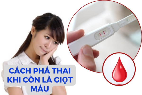 Có thể phá thai khi còn là giọt máu hay không?