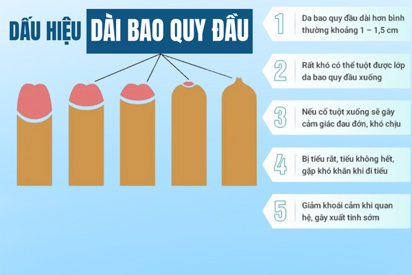 Dai-bao-quy-dau-hieu