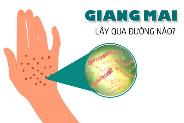 Chuyên gia giải đáp: Giang mai lây qua đường nào?