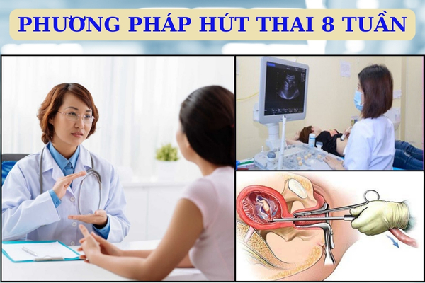 Địa chỉ hút thai 8 tuần ở đâu? Quy trình thực hiện như thế nào?