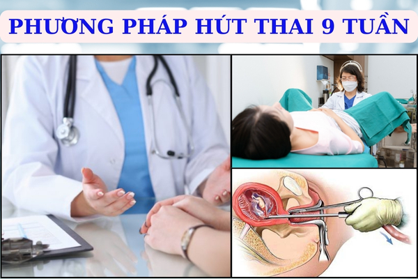 Hút thai 9 tuần