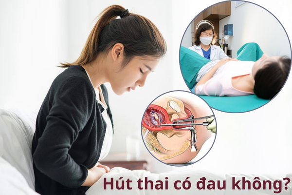 Hút thai có đau không?