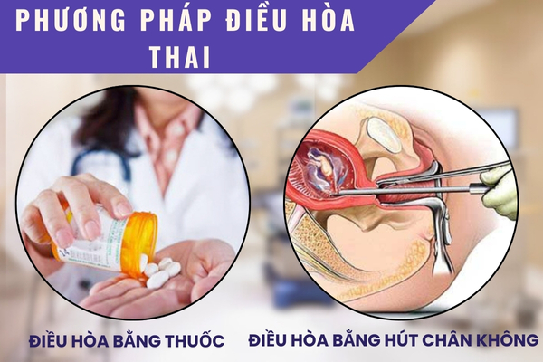 Phương pháp điều hòa thai an toàn – tiết kiệm – hiệu quả