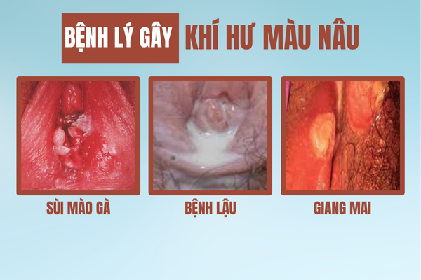 Hieu-dung-khi-hu-mau-nau-de-dieu-tri-hieu-qua-4