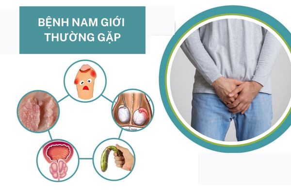 Tìm hiểu bệnh ở nam giới thường gặp