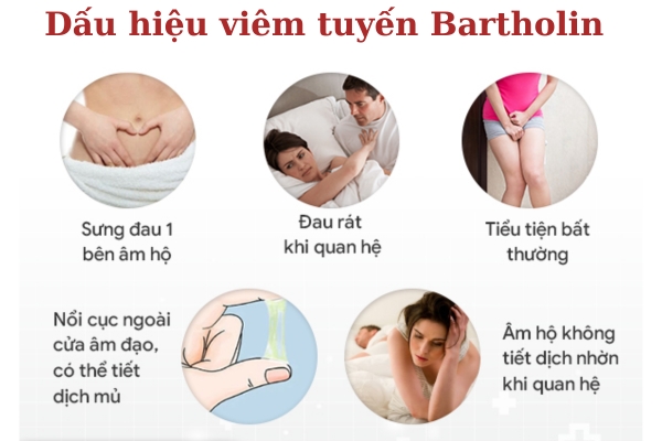 Viem-tuyen-bartholin (4)