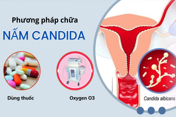 Nam-candida-nguyen-nhan-trieu-chung-va-cach-khac-phuc-hieu-qua-3