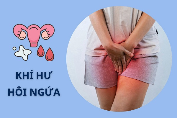 Khi-hu-hoi-ngua
