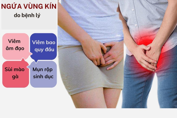 Ngua-vung-kin