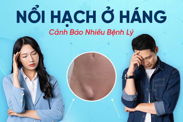 Noi-hach-o-hang