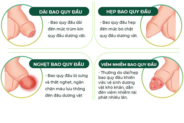 Benh-bao-quy-dau