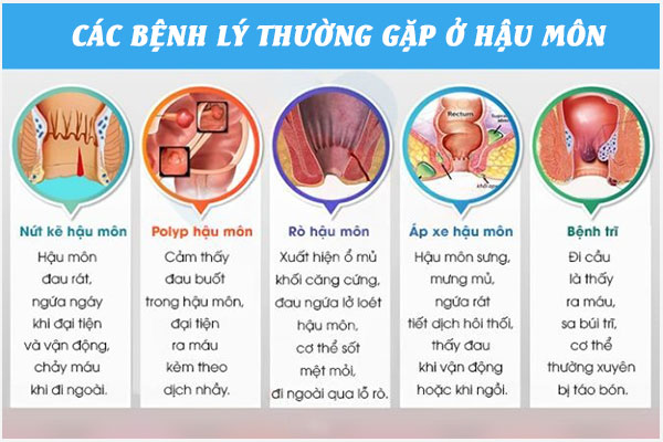 Benh-hau-mon-1