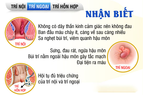 Benh-tri