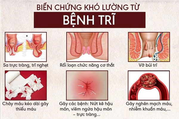 Bien-chung-benh-tri-1