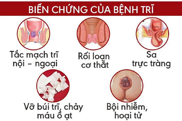 Bien-chung-benh-tri