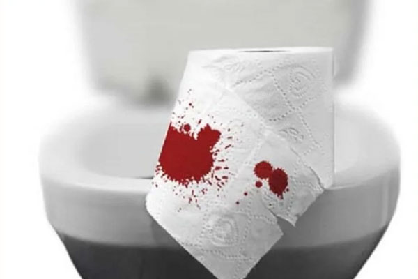 Chảy máu hậu môn do trĩ và Cách khắc phục hiệu quả