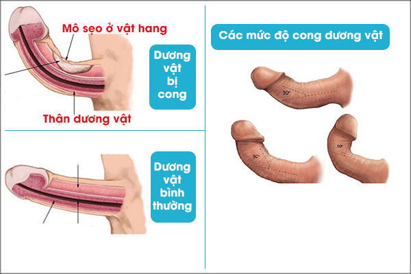 Cong-duong-vat