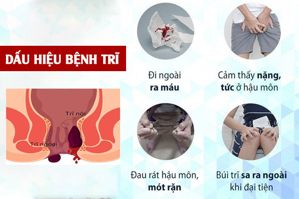 Đi cầu ra máu có phải mắc bệnh trĩ không?
