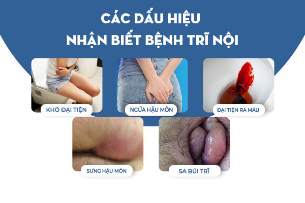 Dau-hieu-tri-noi