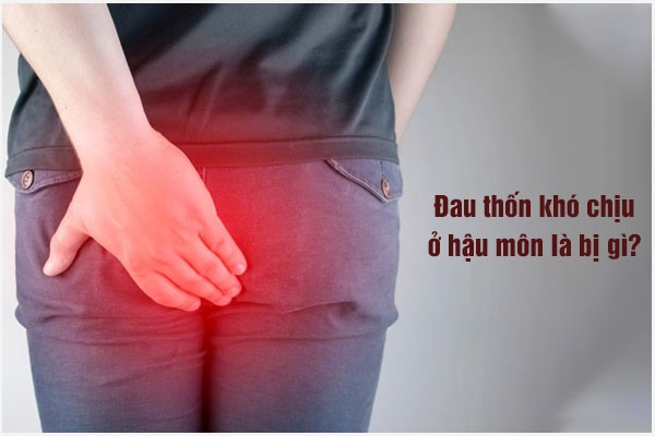 Đau thốn hậu môn: Nguyên nhân, Nguy hiểm và Cách khắc phục