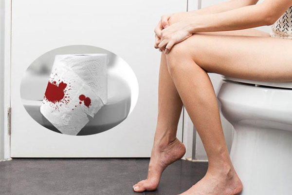 Đi cầu ra máu là biểu hiện của bệnh gì?