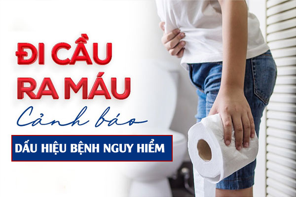 3 Nguyên nhân đi cầu ra máu và cách khắc phục hiệu quả