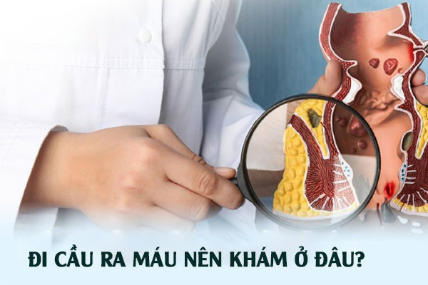 Đi cầu ra máu nên khám ở đâu?