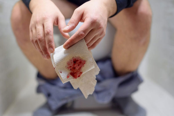 Đi ỉa ra máu có nguy hiểm không?