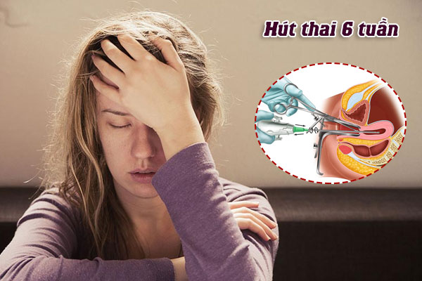 Hút thai 6 tuần có đau không? Phá thai ở đâu an toàn?