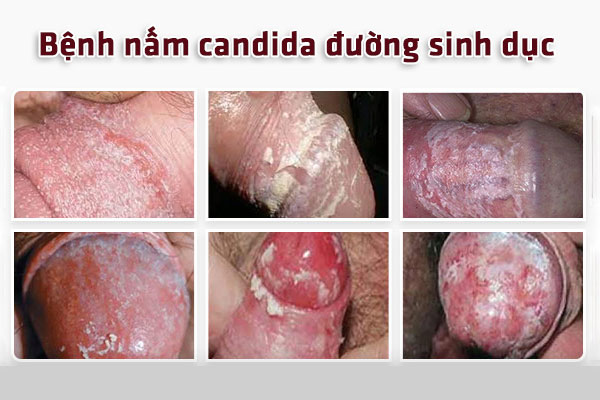 Nam-duong-vat