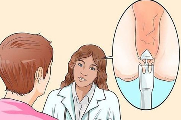 Phương pháp hỗ trợ điều trị trĩ ngoại hiệu quả