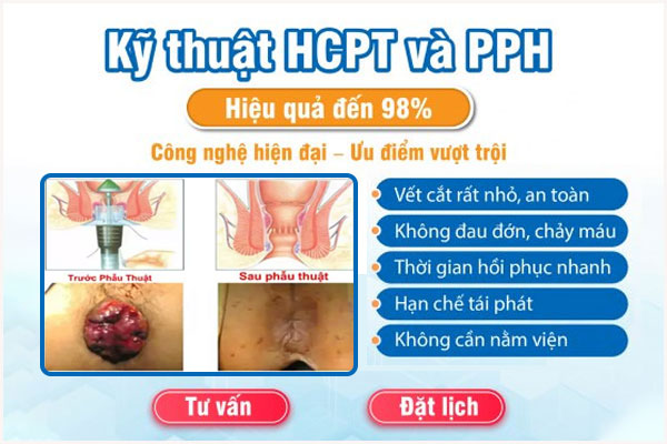 Pp-dieu-tri-benh-tri-pph-va-hcpt-1
